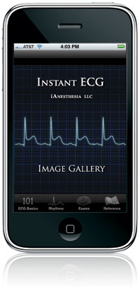 Instant ECG - Image Gallery